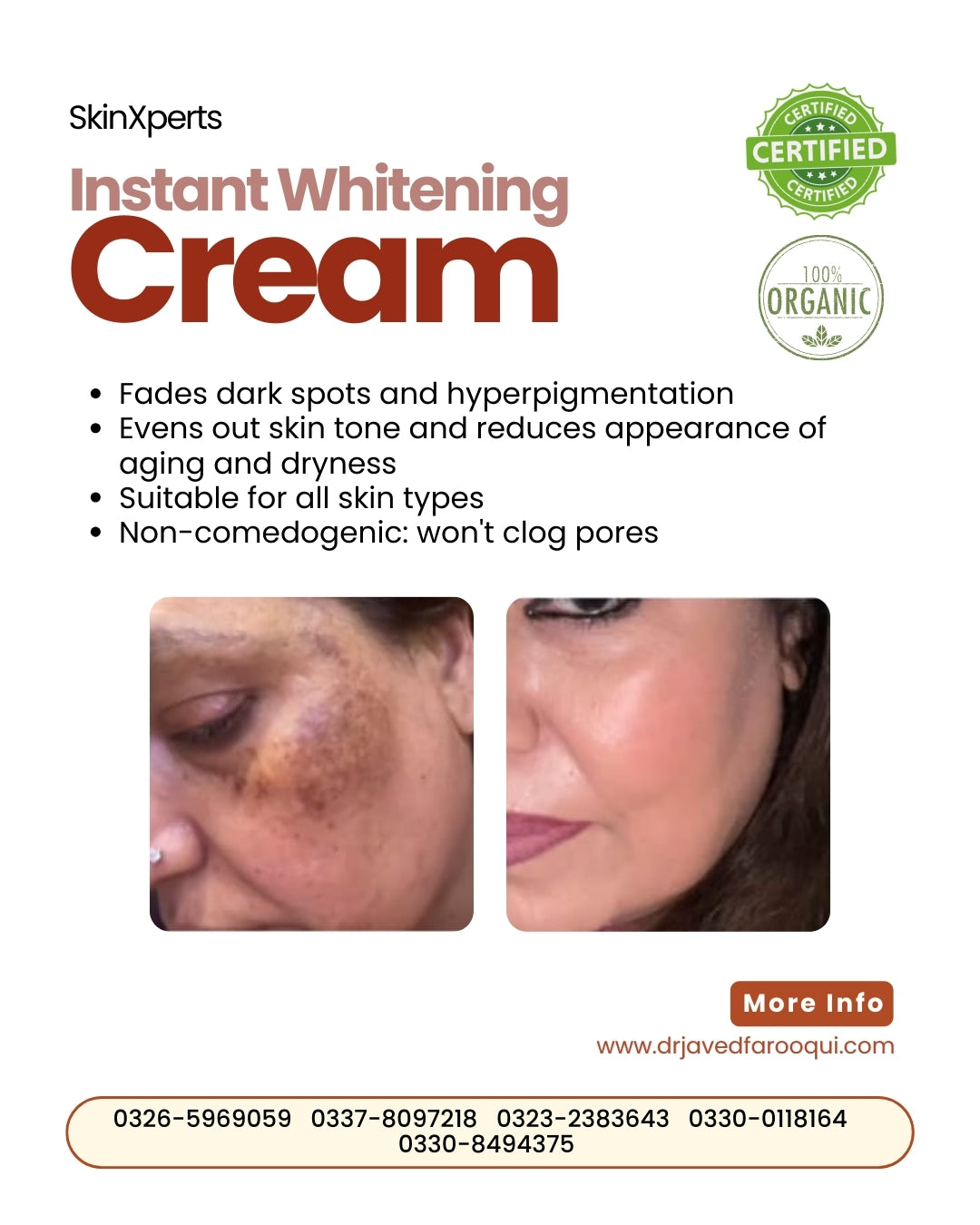 Bride Brightening Box