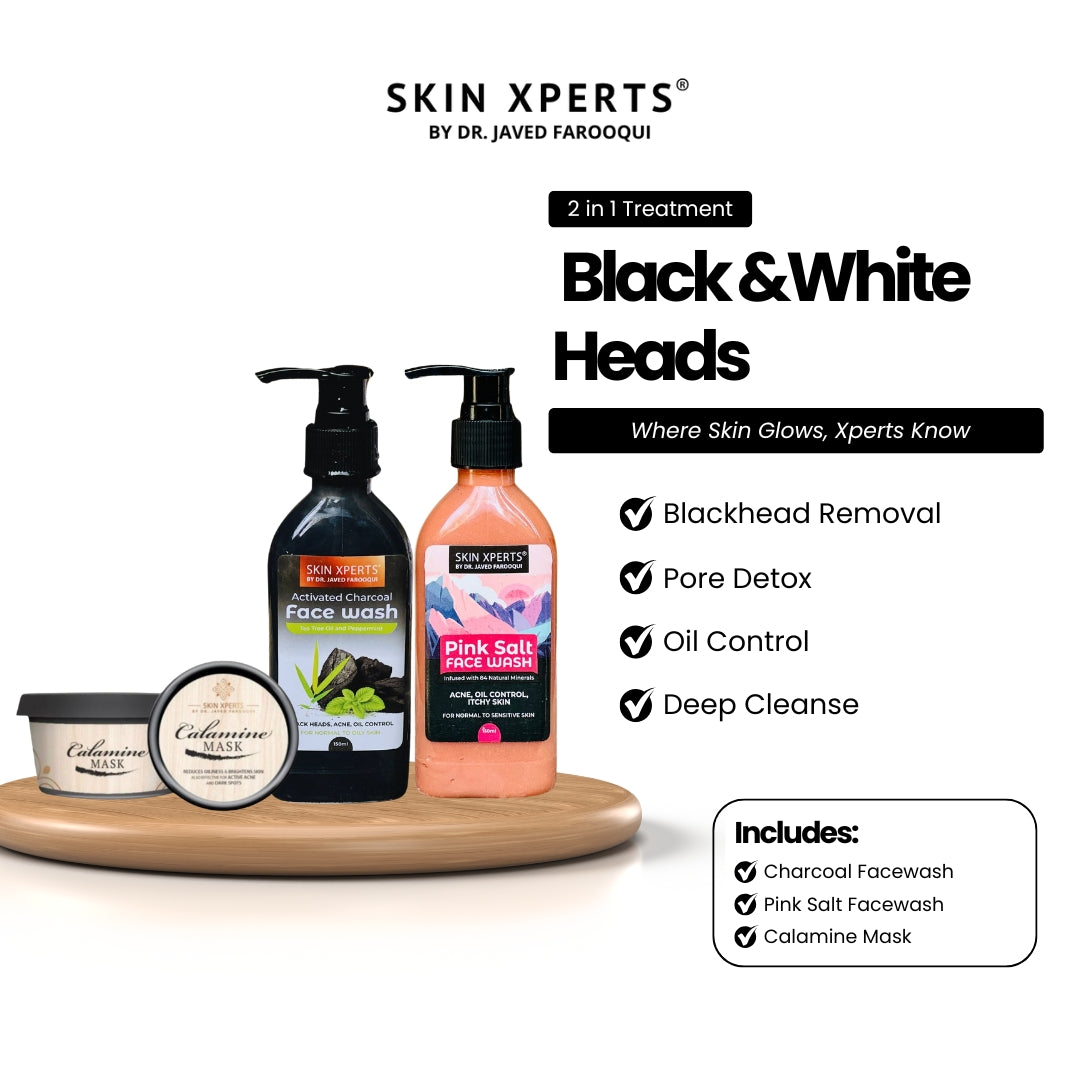 Acne Prone & Black/White Heads Treatment