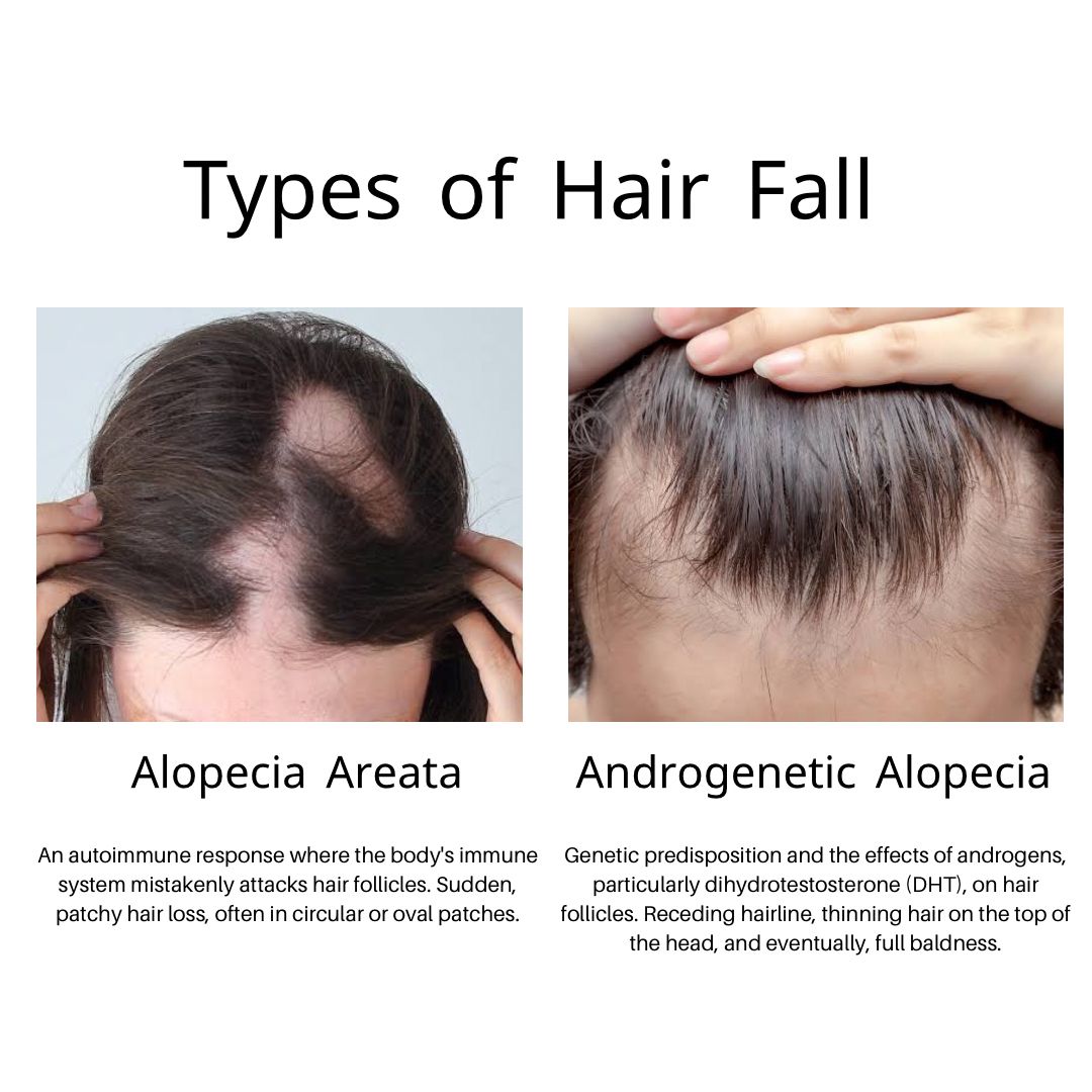 Hair Fall