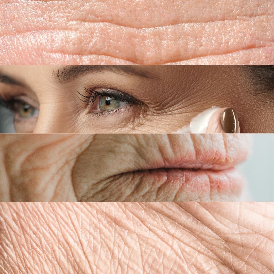 Anti - Ageing