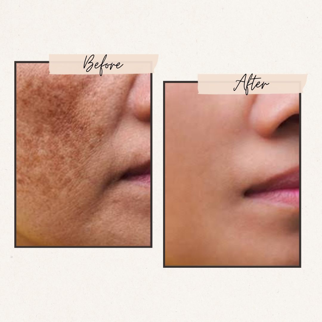 Miracle Advance Brightening Cream with Arbutin & Niacinamide Complex